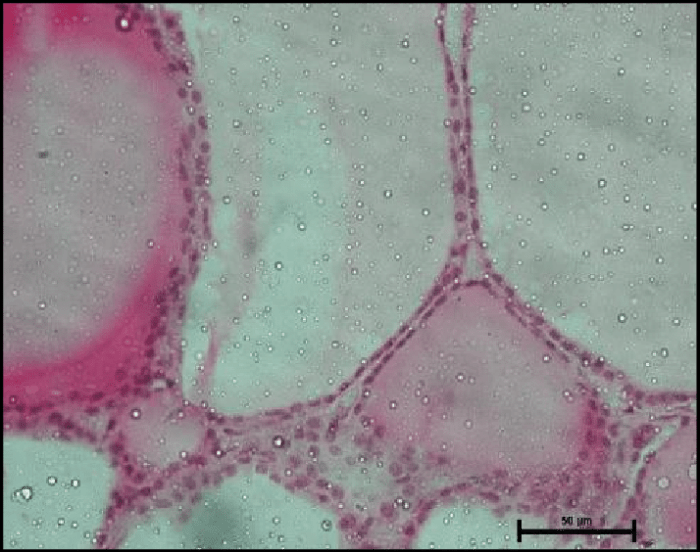 Ride horseback on the thyroid gland